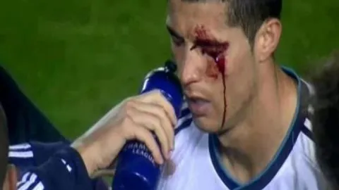 不来梅德甲逆袭，斯特奇独中四元成就帽子戏法